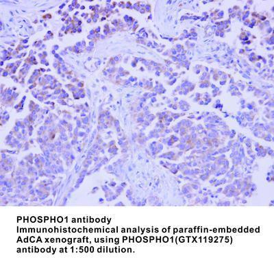 PHOSPHO1 antibody, GeneTex