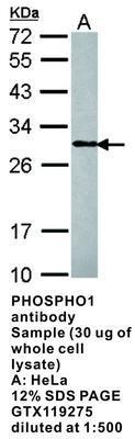 PHOSPHO1 antibody, GeneTex