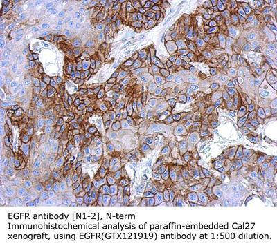 EGFR antibody [N1-2], N-term, GeneTex