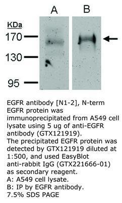 EGFR antibody [N1-2], N-term, GeneTex