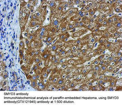 SMYD3 antibody, GeneTex