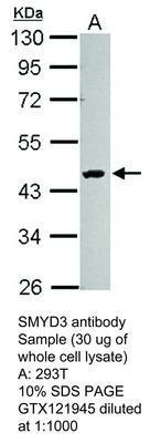 SMYD3 antibody, GeneTex