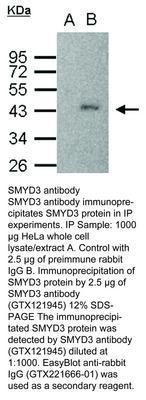 SMYD3 antibody, GeneTex