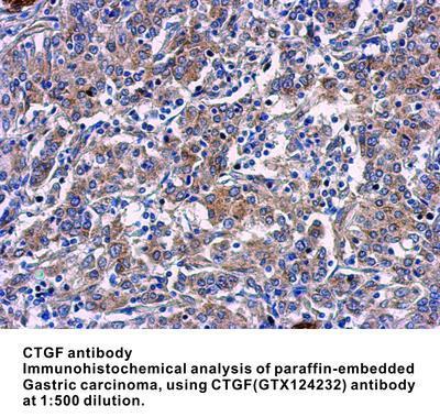 CTGF antibody - Rabbit Polyclonal - IHC-P, WB - 100µl, GeneTex