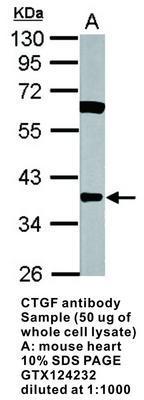 CTGF antibody - Rabbit Polyclonal - IHC-P, WB - 100µl, GeneTex