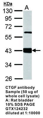 CTGF antibody - Rabbit Polyclonal - IHC-P, WB - 100µl, GeneTex