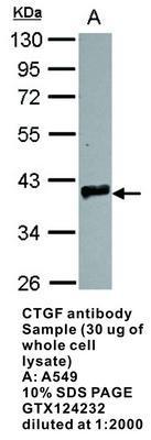 CTGF antibody - Rabbit Polyclonal - IHC-P, WB - 100µl, GeneTex