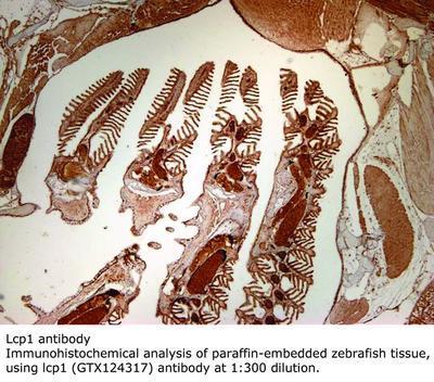 Lcp1 antibody, GeneTex