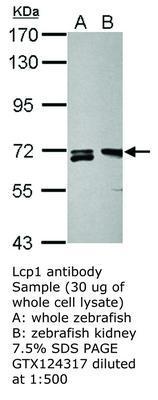 Lcp1 antibody, GeneTex