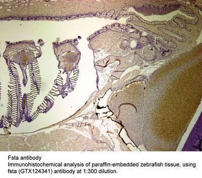 Fsta antibody, GeneTex