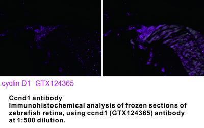 Ccnd1 antibody, GeneTex