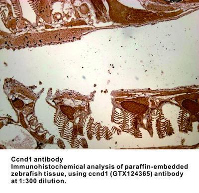 Ccnd1 antibody, GeneTex