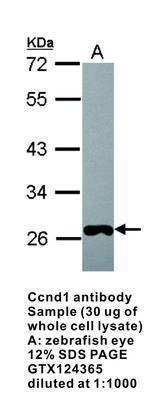 Ccnd1 antibody, GeneTex