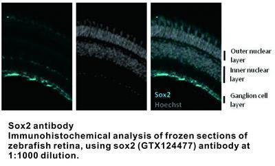 Sox2 antibody - 50µl, GeneTex