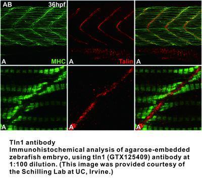 Tln1 antibody, GeneTex