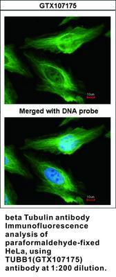 beta Tubulin antibody - Rabbit Polyclonal - ICC/IF, WB - 100µl, GeneTex