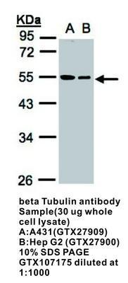 beta Tubulin antibody - Rabbit Polyclonal - ICC/IF, WB - 100µl, GeneTex