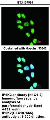 IP6K2 antibody [N1C1-2], GeneTex