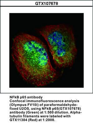 NFkB p65 antibody - 100µl, GeneTex