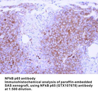 NFkB p65 antibody - 100µl, GeneTex