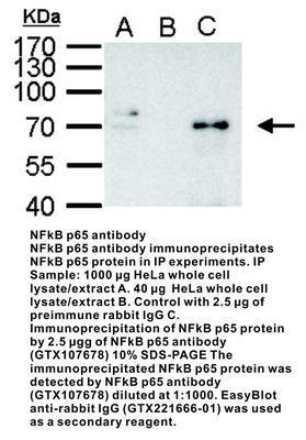 NFkB p65 antibody - 100µl, GeneTex