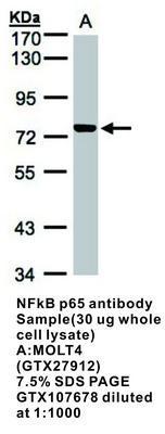 NFkB p65 antibody - 100µl, GeneTex