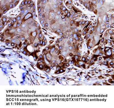 VPS16 antibody, GeneTex