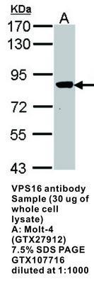 VPS16 antibody, GeneTex