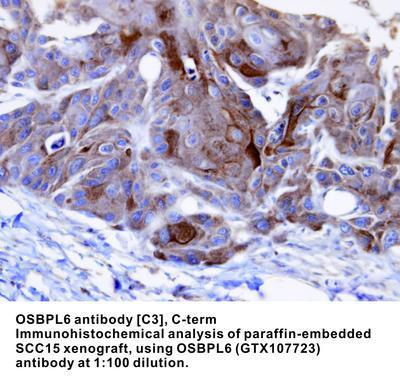 OSBPL6 antibody [C3], C-term, GeneTex