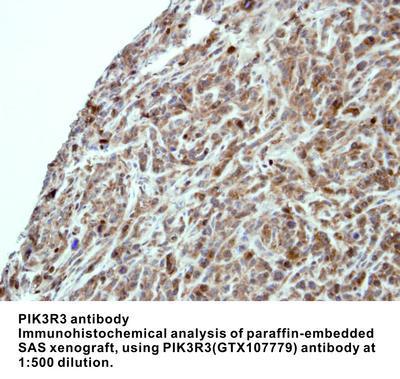 PIK3R3 antibody [N3C3], GeneTex