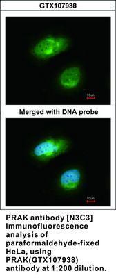 PRAK antibody [N3C3], GeneTex