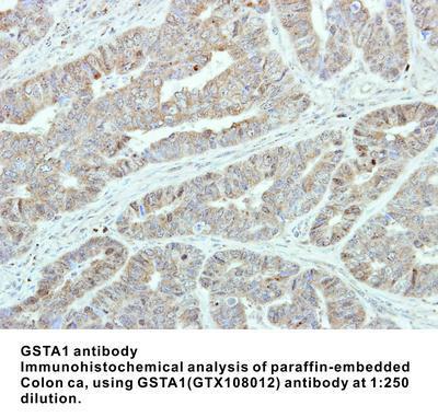 GSTA1 antibody - Rabbit Polyclonal - ICC/IF, IHC-P, WB - 100µl, GeneTex