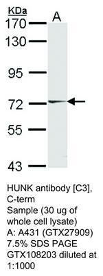 HUNK antibody [C3], C-term, GeneTex