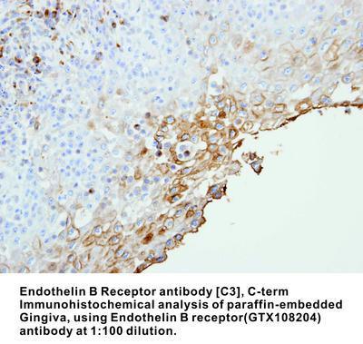 Endothelin B receptor antibody [C3], C-term, GeneTex