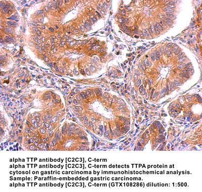 alpha TTP antibody [C2C3], C-term, GeneTex