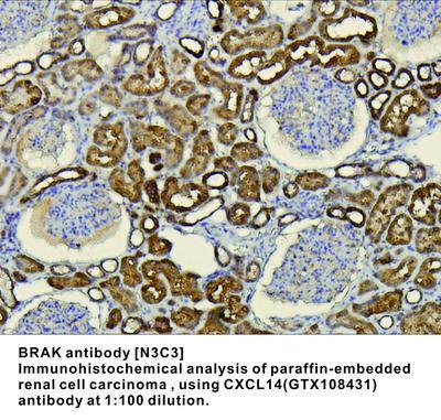 BRAK antibody [N3C3], GeneTex