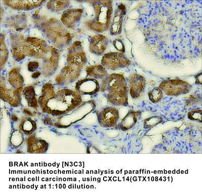 BRAK antibody [N3C3], GeneTex