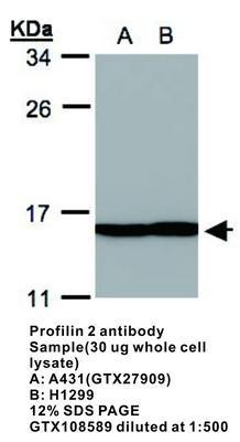 Profilin 2 antibody - 100µl, GeneTex