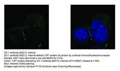 ZO-1 antibody [N2C1], Internal, GeneTex