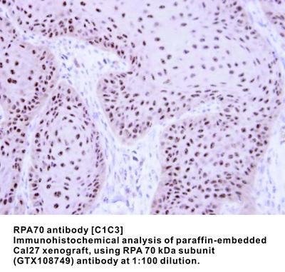 RPA70 antibody [C1C3], GeneTex