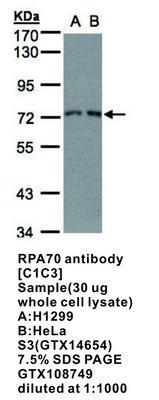 RPA70 antibody [C1C3], GeneTex