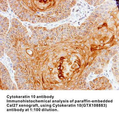 Cytokeratin 10 antibody, GeneTex