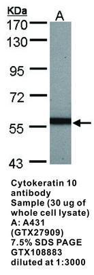 Cytokeratin 10 antibody, GeneTex