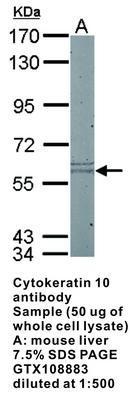 Cytokeratin 10 antibody, GeneTex