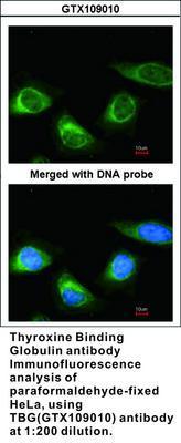 TBG antibody [N1C3], GeneTex