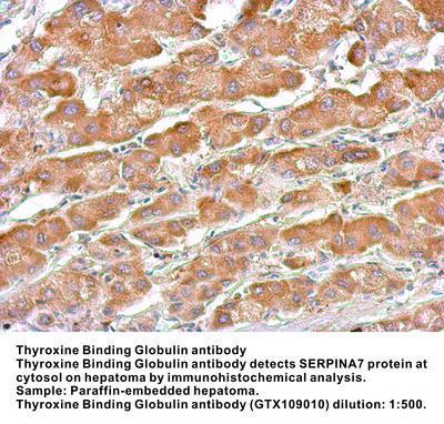 TBG antibody [N1C3], GeneTex