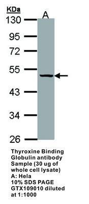 TBG antibody [N1C3], GeneTex