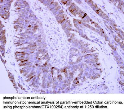 phospholamban antibody, GeneTex