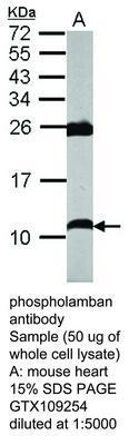 phospholamban antibody, GeneTex