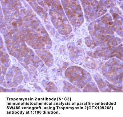 Tropomyosin 2 antibody [N1C3], GeneTex